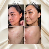 Avant/après exfoliation avec le gant en soie : peau plus lisse et éclatante